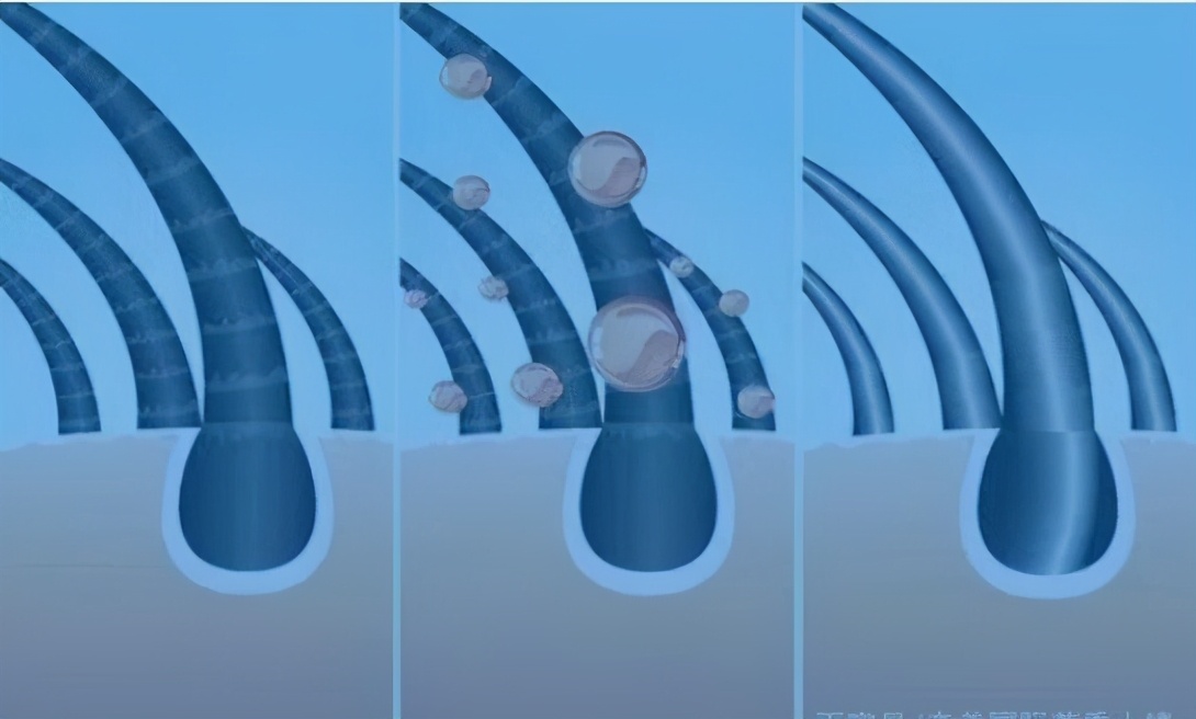 别再随便洗头了，只要几步枯草变绸缎，枯发变秀发