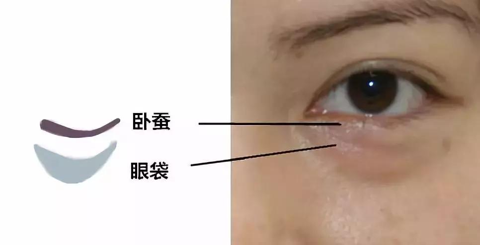 有眼袋太显老祛眼袋这里有妙招,有眼袋显老十岁一招教你消除