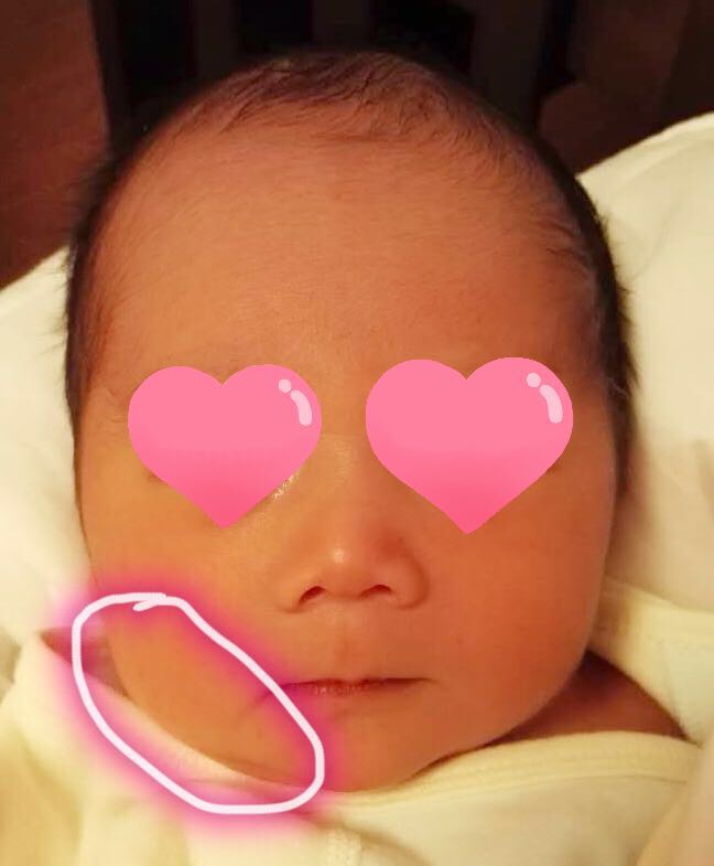 新生儿头总是偏向一侧身体平躺,新生儿头一直往左偏