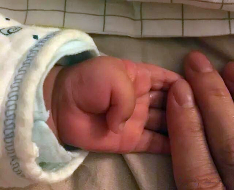 宝宝拇指内扣是一直内扣吗,一般几个月婴儿拇指内扣是正常