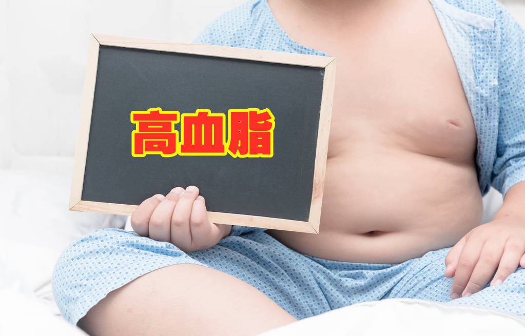 关于高血脂的四个知识,专家说对付高血脂的最好办法是