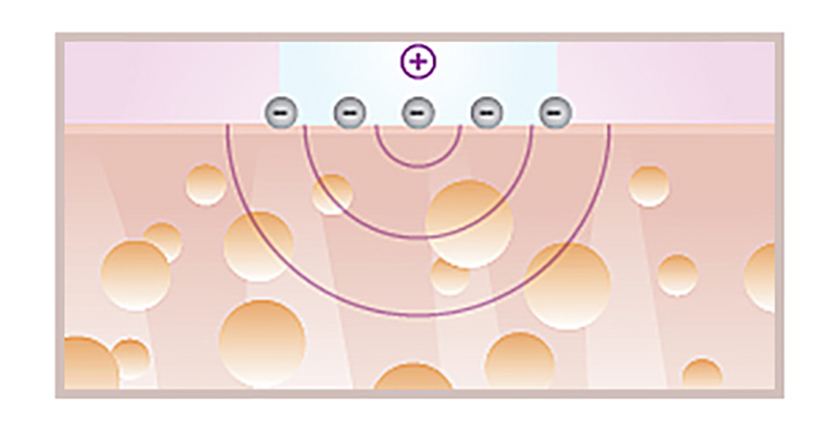 夏季混干皮如何美白,干皮怎么美白学生
