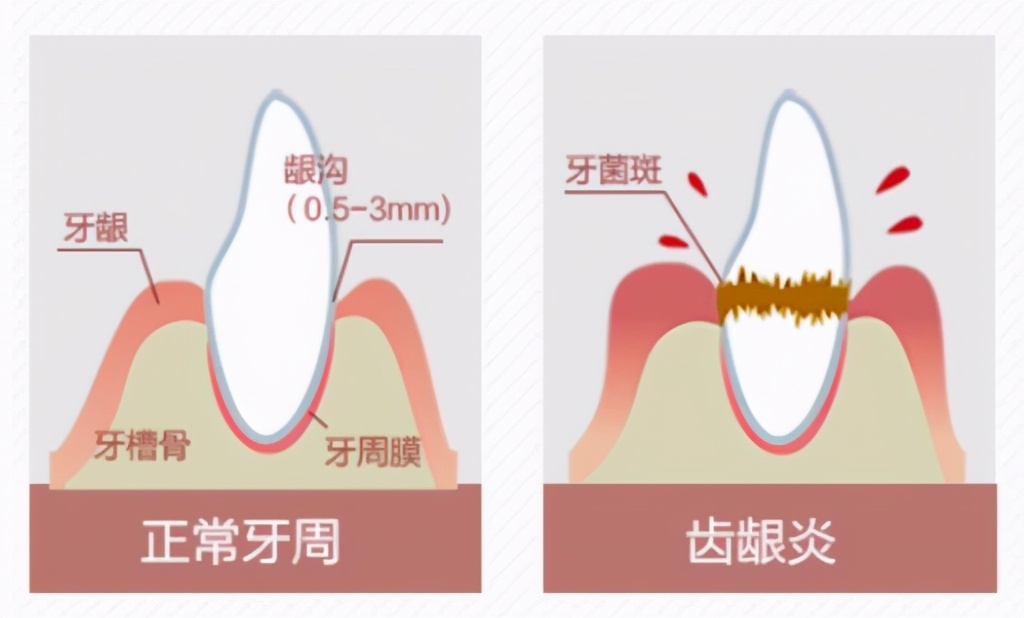 罗曼W10冲牙器拆卸方法,罗曼小宝塔冲牙器
