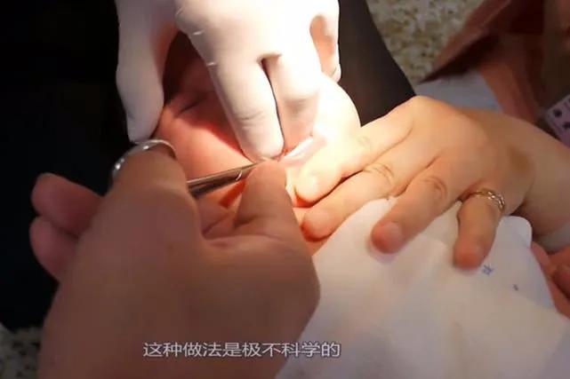 语言发育迟缓宝宝讲话大舌头,宝宝学说话有点结巴正常吗