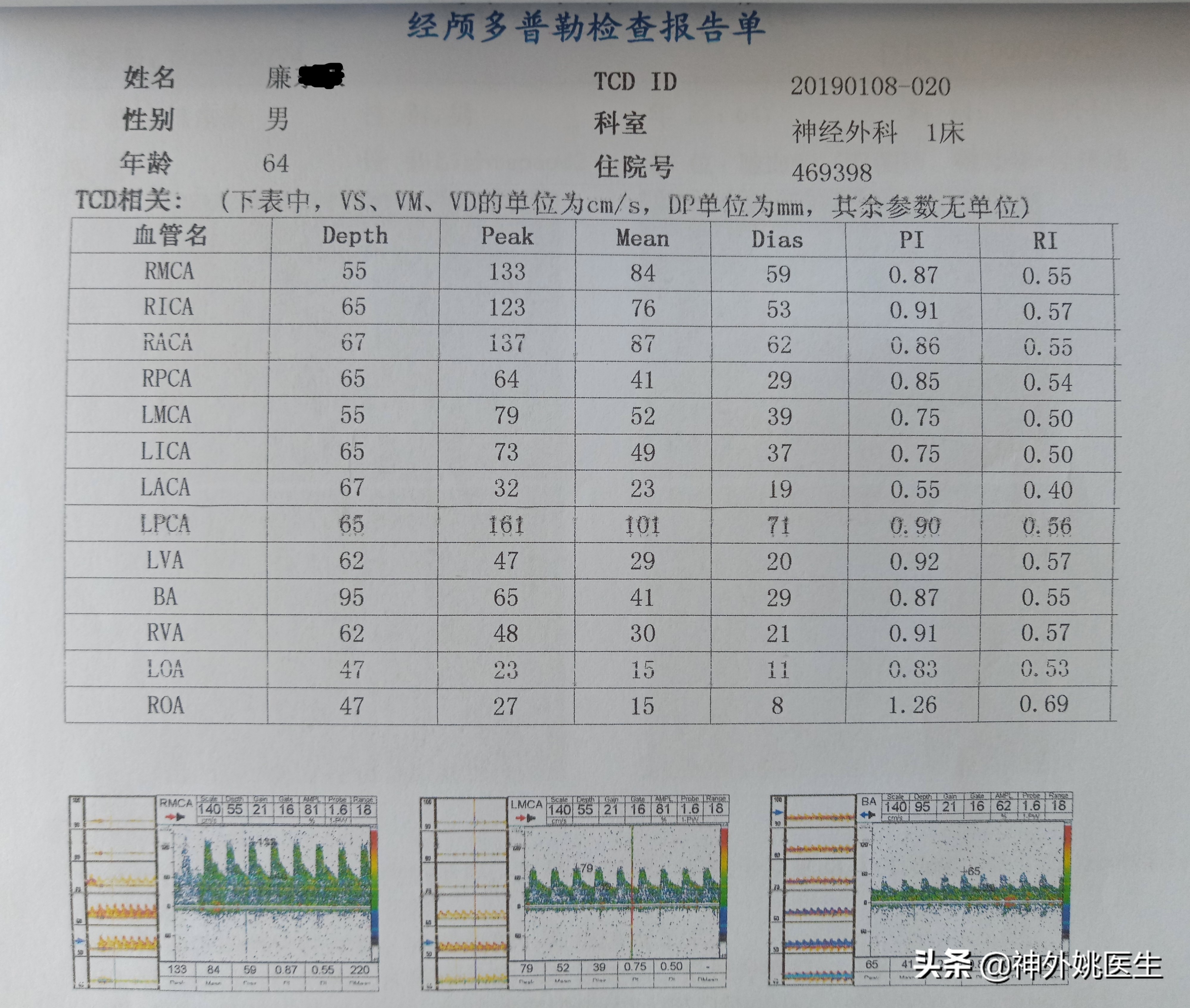 颈内动脉狭窄内膜剥脱术风险大吗,颈动脉内膜摘除手术