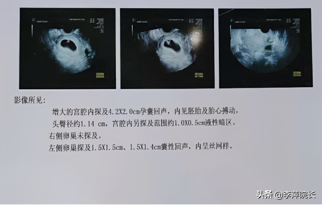 慢性炎症反反复复，主任：三年不怀很正常，好孕都被你们耽误了