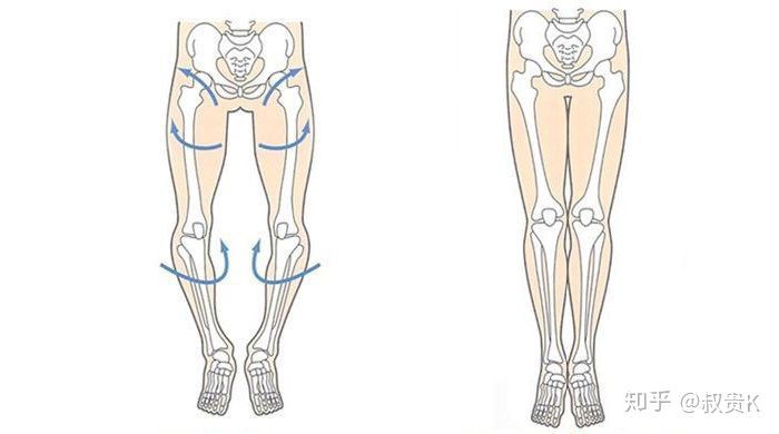 小腿不直该怎么办,小腿不直肌肉外翻怎么办