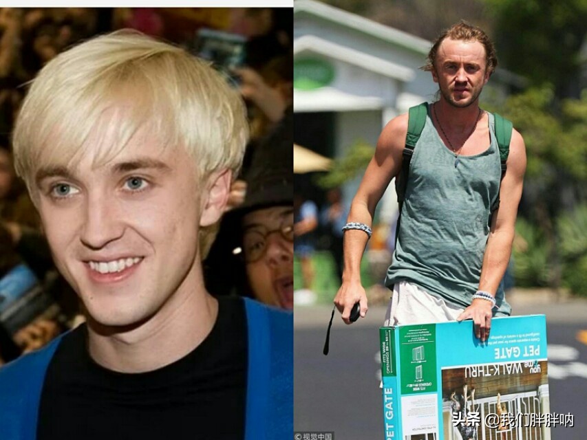 女生秃头的原因及治疗,女生为什么秃头怎么拯救