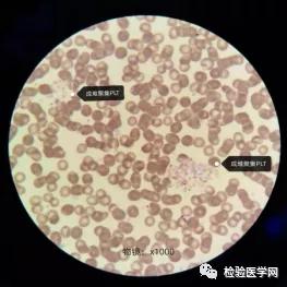 “秒”看血小板聚集，你get到了吗？