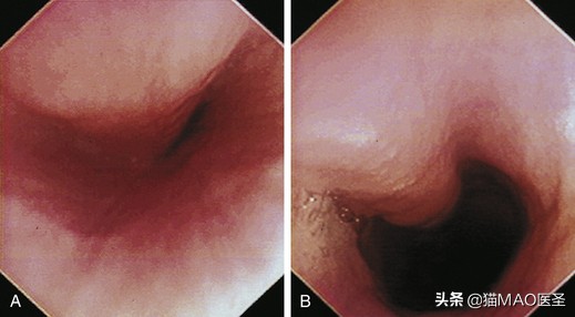 犬猫内窥镜检查气管食道,猫狗内窥镜