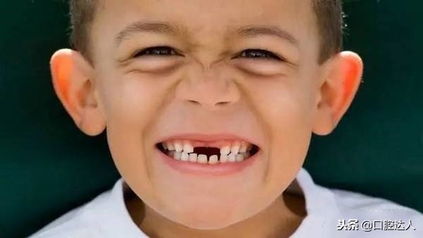 6岁的女孩换牙期注意事项,孩子要换牙了应该注意什么