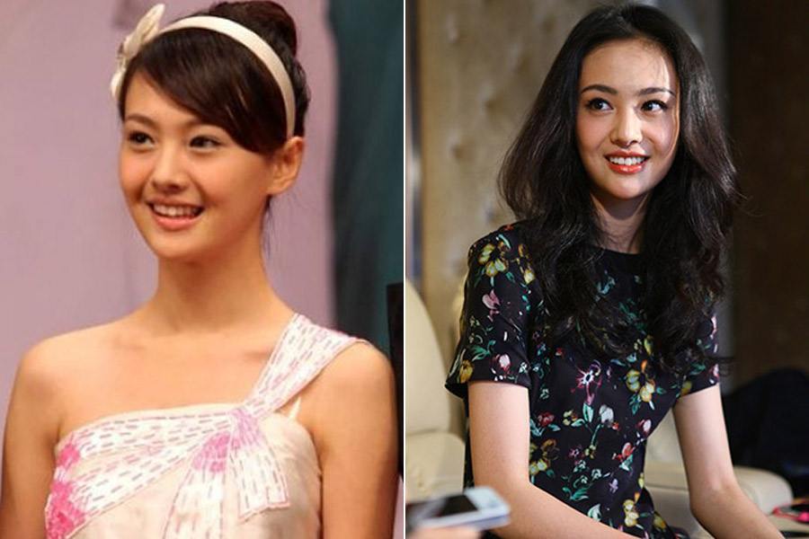 郑爽又开始减肥,体重只有88斤仍拒绝进食,这样的苗条真的好吗?