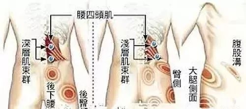 肌筋膜炎做什么检查能查出来,肌筋膜炎最佳治疗方法