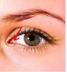 眼睛开内外眼角会过大吗,开内眼角露红肉太多了咋办