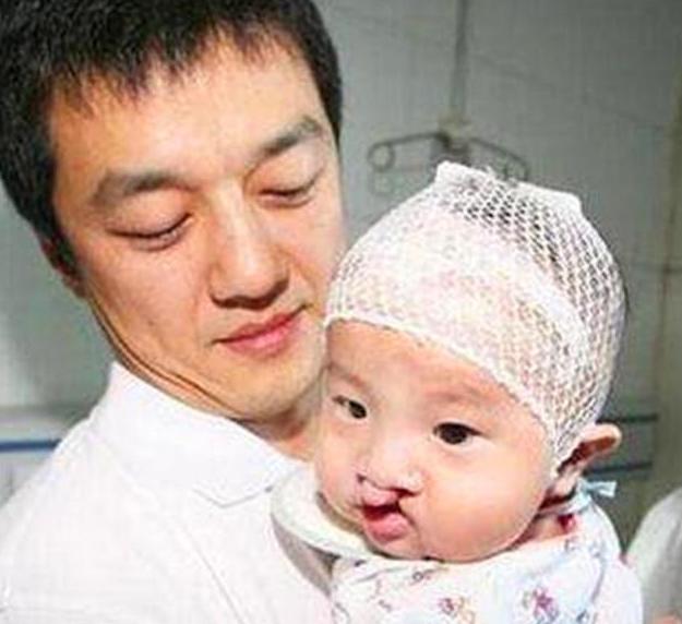 李嫣因兔唇不自信的吗,李嫣然为什么会兔唇