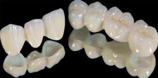 做了牙齿矫正感觉戴牙套好丑啊,做了根管有炎症医生就让戴牙套