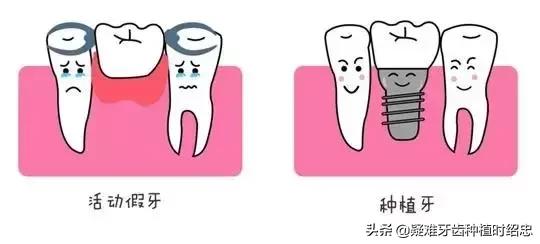 缺牙、补牙,这5大坑你掉进去了吗?