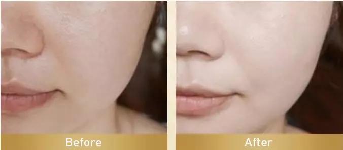 38岁全智贤不愧是国民女神 (年轻时的全智贤满满的胶原蛋白)