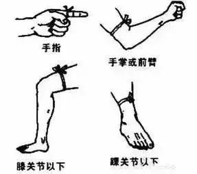 游客被毒蛇咬伤怎么处理,广西一名男子被五毒蛇咬伤