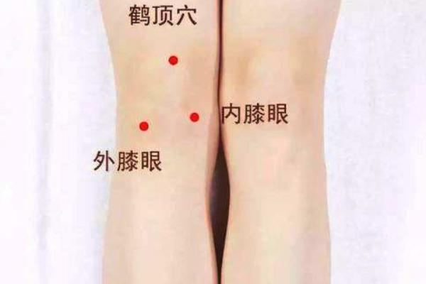 治疗鹤膝风的穴位,膝关穴的位置和作用