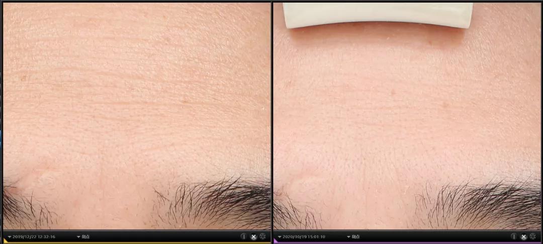 抗衰产品哪个品牌最好,性价比超高的油皮抗衰水