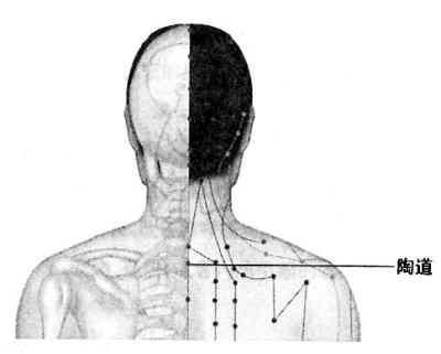 治疗颈椎病的6个有效方法,颈椎病怎么治疗最快最有效推拿