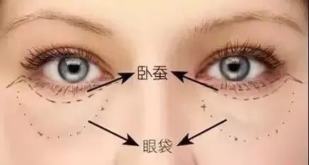 眼袋消除三个方法,教你一个简单消除眼袋的方法