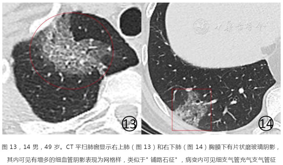 磨玻璃阴影怎么处理,磨玻璃阴影