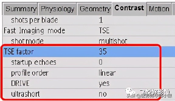 飞利浦磁共振图像操作,飞利浦磁共振成像序列及应用