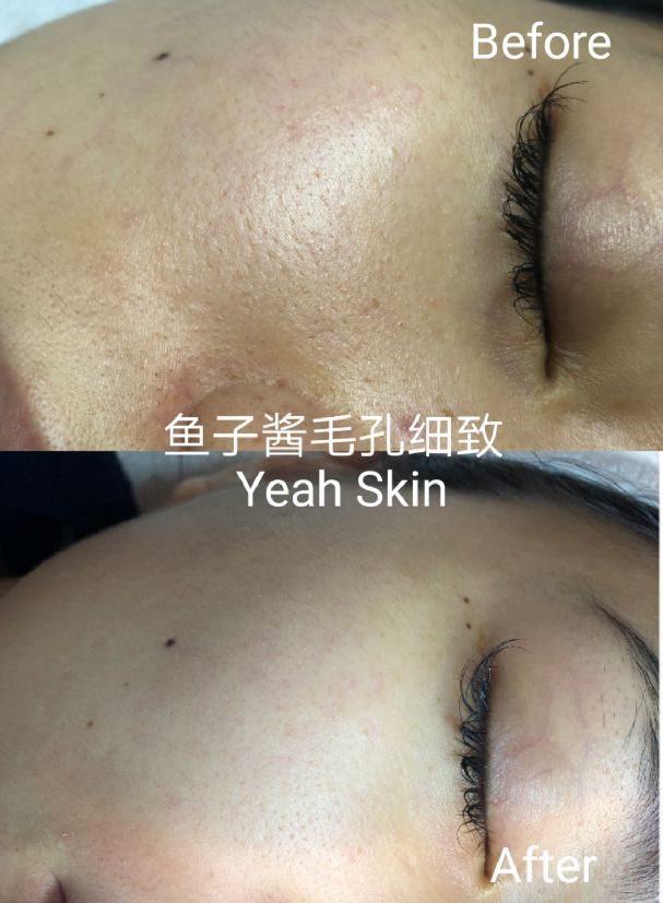 每周一次精准有效的皮肤管理,选对护肤方法让你做靓丽女神