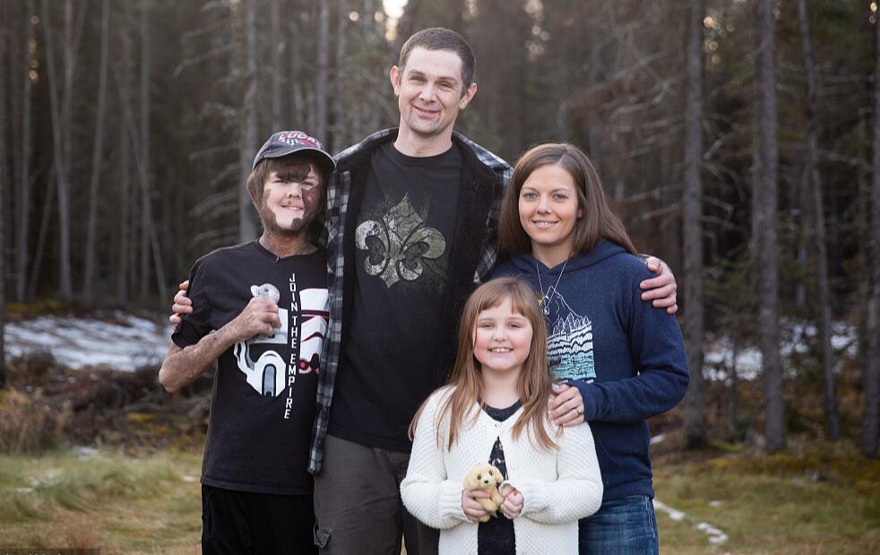 美国男孩患罕见疾病,美国男孩患绝症