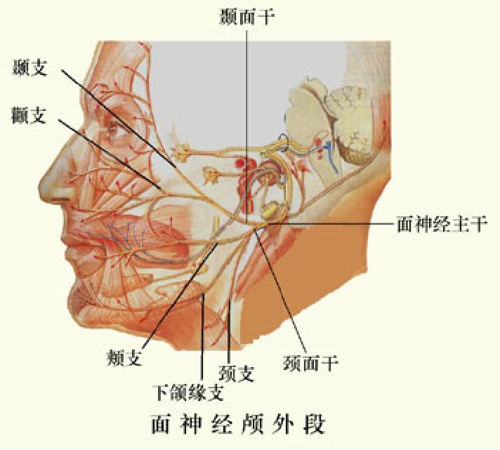 面神经炎治疗自述,面神经炎科普视频