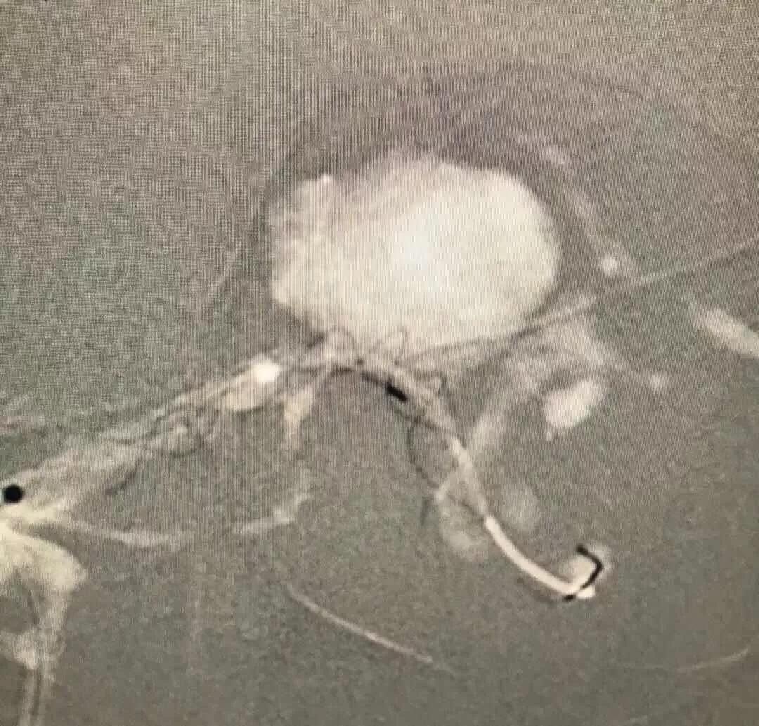 山西省人民医院任少华教授,山西省人民医院任少华