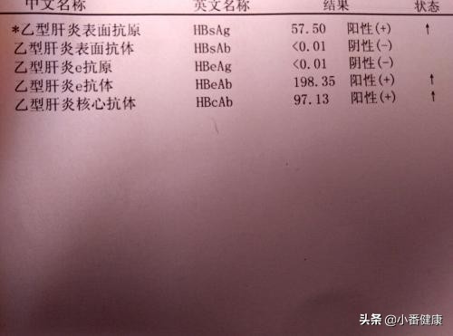 乙肝145阳性肝功能异常怎么办,乙肝145阳性肝功能正常能自愈吗