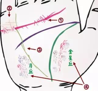 掌纹诊病图片,掌纹能查出糖尿病吗