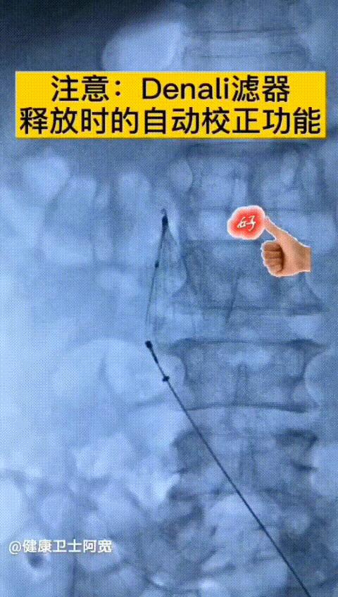 丨传承·创新丨——多学科协作奏响凶险骨折患者生命乐章