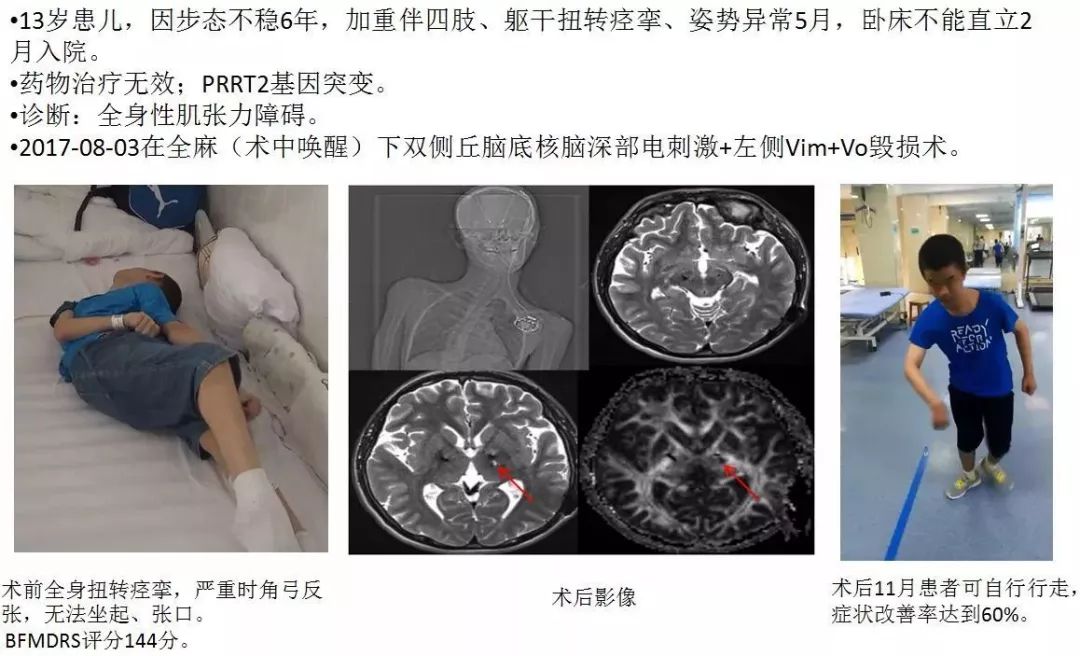 第二人民医院巡回义诊,深圳市二院义诊