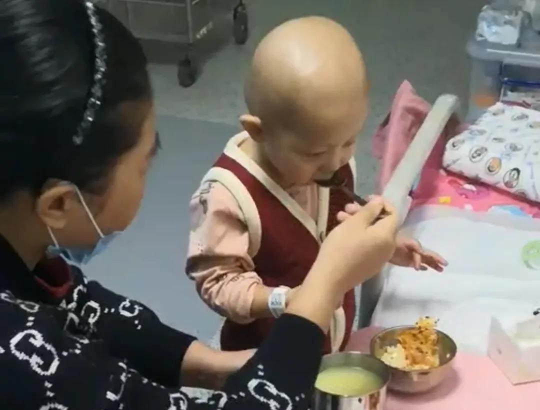 儿童白血病身上起小红点图片,白血病小红点刚开始图片