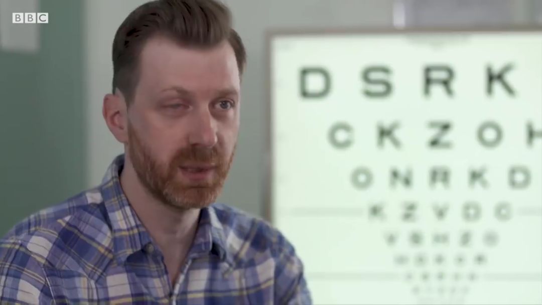 全球超过22亿人视力受损，干细胞疗法逆转过去无法治愈的失明