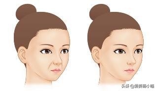 法令纹深有什么拯救方法,减肥脸上出现法令纹怎么拯救