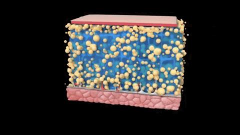 瘦的代价是什么,抽脂代价