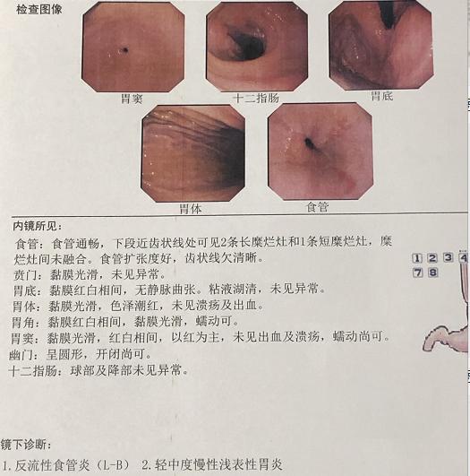 胸闷气短是身体出什么问题了,胸闷到底是哪里出问题了