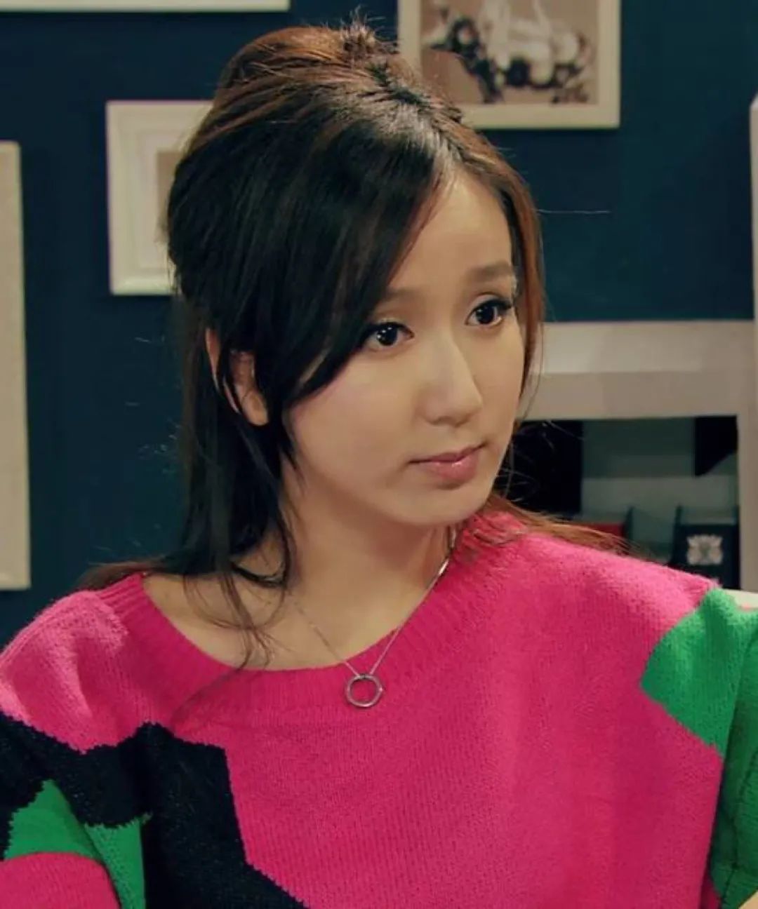 娄艺潇填充脂肪前后对比,娄艺潇填充前后对比