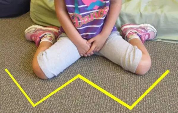 七个月宝宝小腿弯是罗圈腿吗,宝宝小腿拐怎么回事