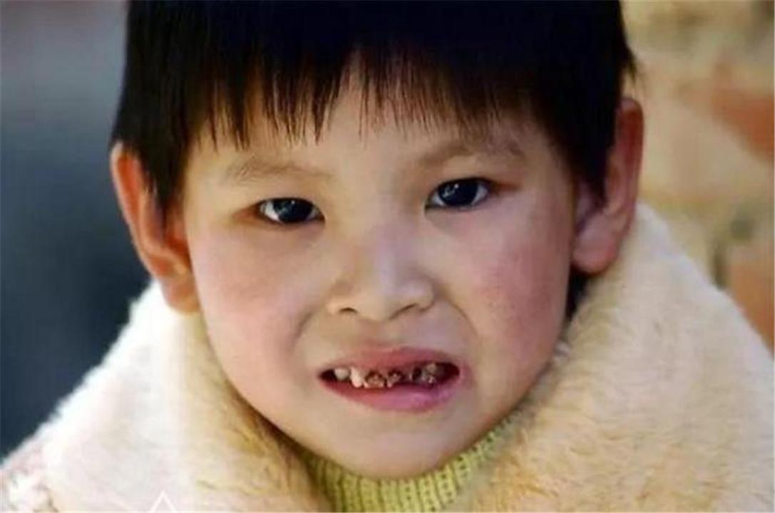 两岁宝宝牙疼但是牙医看了没事,妈妈我牙疼了原版