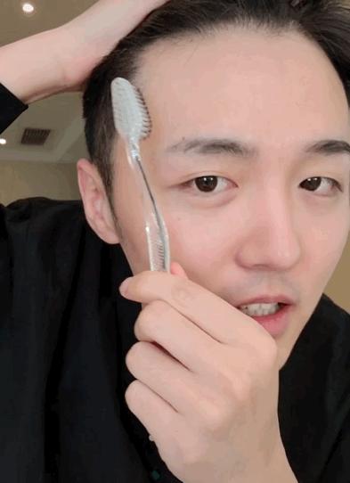 颅顶高了但发际线高怎么办,颅顶低的几种补救办法