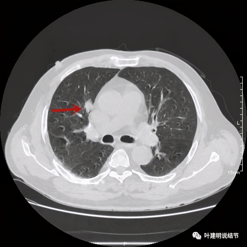 误诊报告图片,误诊案例及案例分析