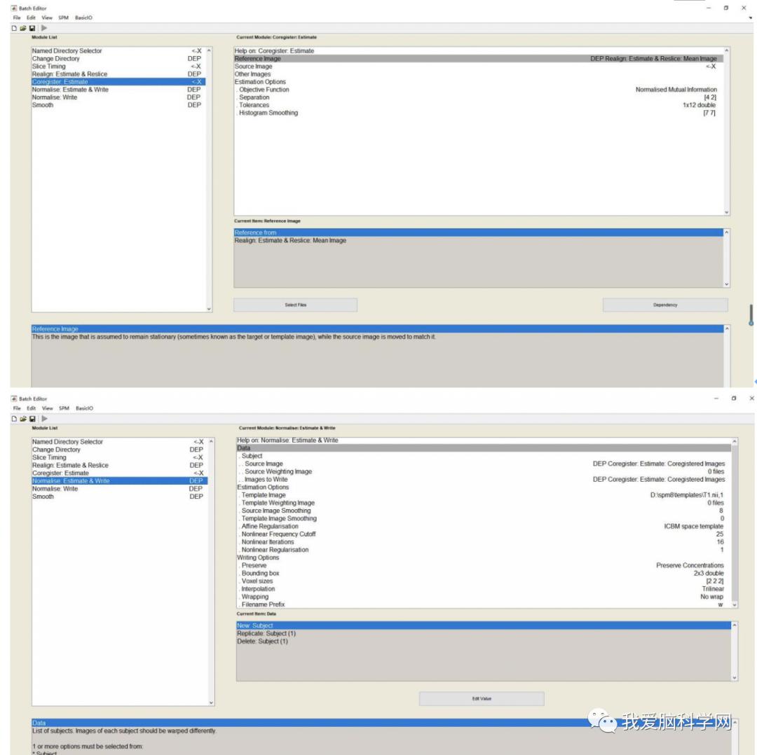 脑功能报告解读,颅脑mri信号讲解视频教程