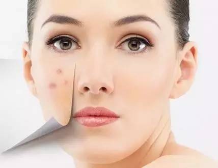 痘印黑头暗沉?简单3步养出婴儿肌