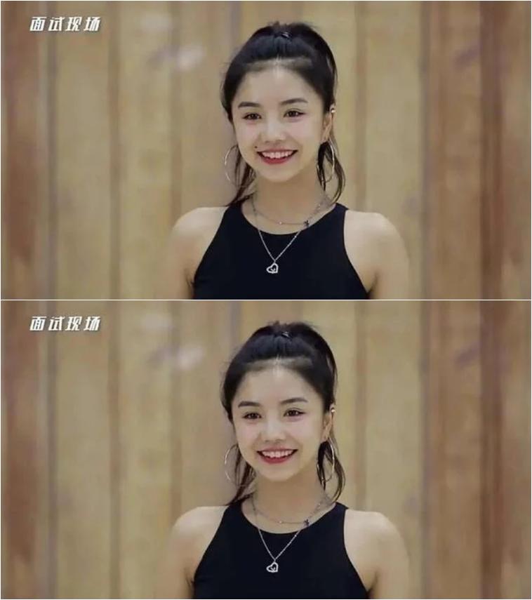 媒婆痣安崎,安崎要不要遮痣